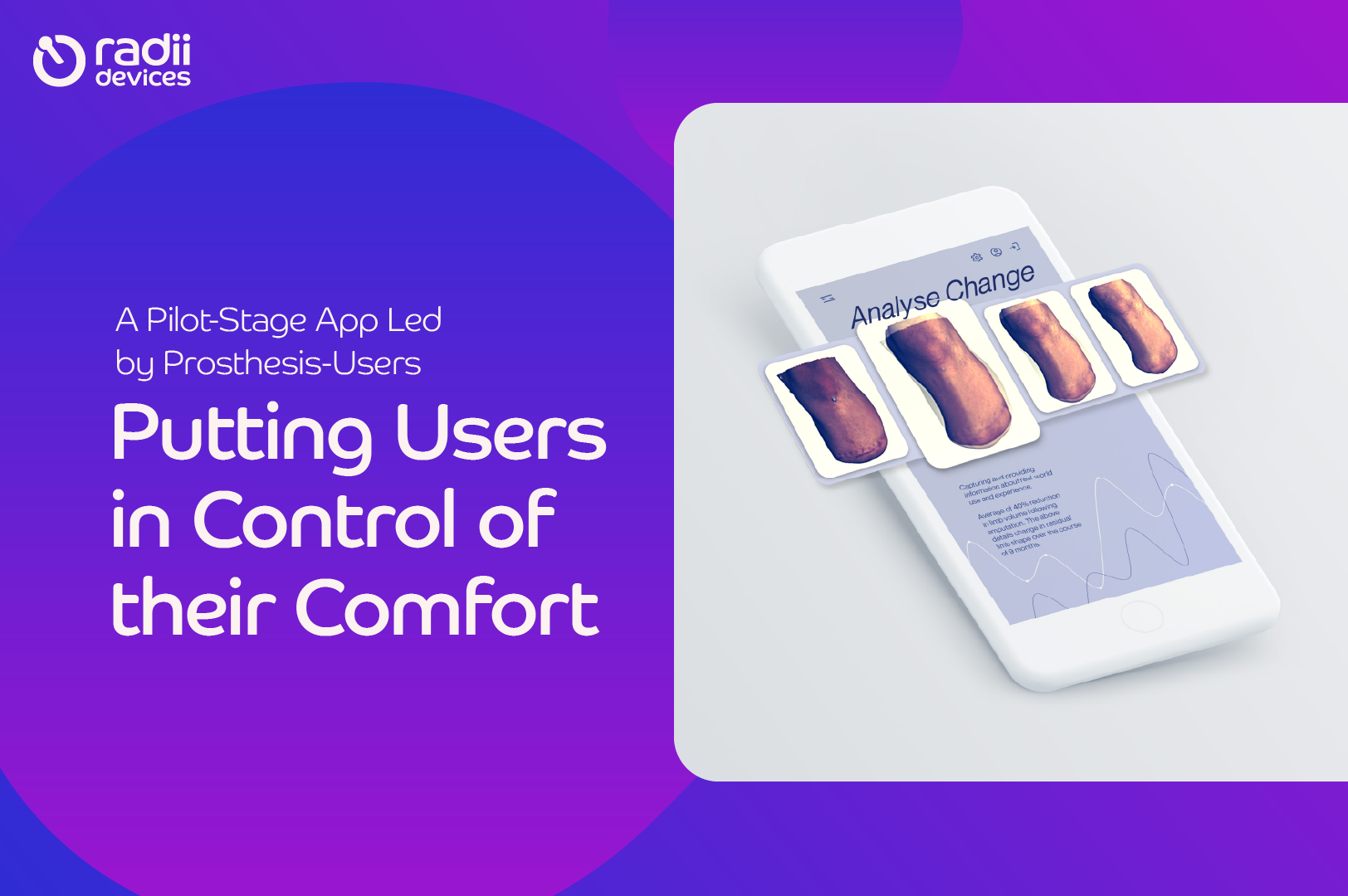 Image of app that says "Analyse Change" with four limbs changing in shape over time. On the right, text that sayd "A Pilot-Stage App Led by Prosthesis-Users, Putting Users in Control of their Comfort".